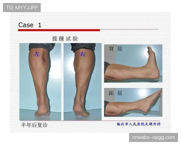 健康专题：运动医学专家解析高节奏比赛对球员跟腱与膝盖的长期影响